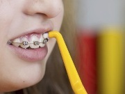 Dinții eșantionează ce trebuie să facă, decât să te întărești, să-i ajuți pe stomatologi
