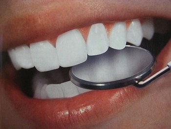 Implanturi dentare minune
