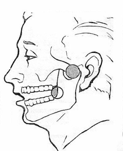 Arthritis на темпоромандибуларната става симптомите и лечението