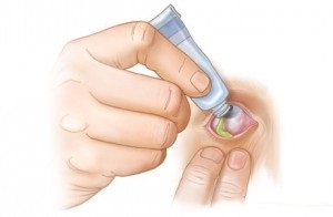 Aciclovir pentru ochi și reguli de dozare