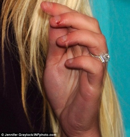 Britney Spears își mușcă degetele în sânge, plitkar