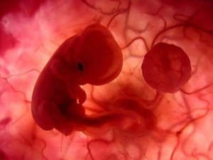 Ce este placenta previa și ce să faceți cu această patologie