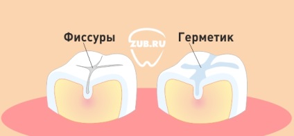 Stomatologie pentru copii