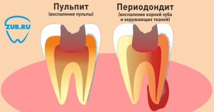 Stomatologie pentru copii