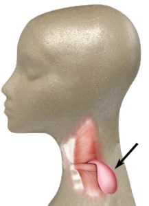 Diverticulul esofagian cauzează, simptome, tratament, gastrolife