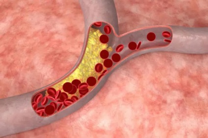De ce avem nevoie de colesterol pentru funcția corpului nostru