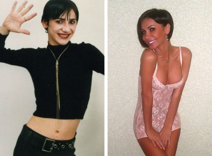 Erica este o operație intestinală de schimbare a sexului; față și corp; fotografie înainte și după
