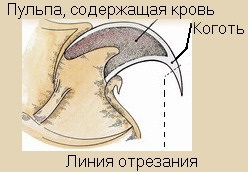 Тази страница е за болестта нокти нейната превенция причини лечение на общи симптоми