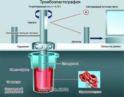 Flebita simptomelor și a tratamentului la extremitățile inferioare, cauze, tipuri de patologie