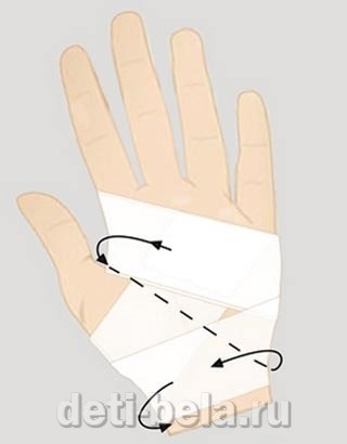 Fond de copii fluturi - bandajarea degetelor cu bandaj