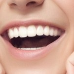 Fluorizarea profundă a dinților