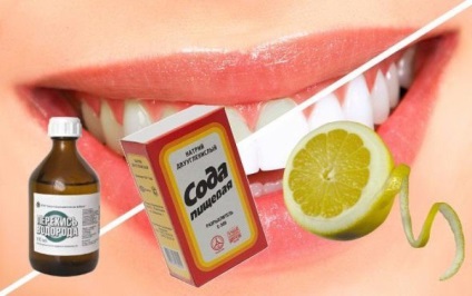 Hogyan fehérítheti fogát otthon, anélkül, hogy ártalmas lenne a zománc és az íny, szép