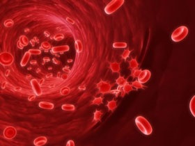 Cum se reduce hemoglobina în sânge