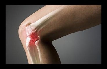 Cum de a consolida genunchi și exerciții ligament pentru a consolida articulația genunchi, antrenament pentru warm-up și