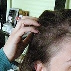 Milyen frizurát kell csinálnunk ahhoz, hogy eltávolítsuk a bhaktátot a kmax fején