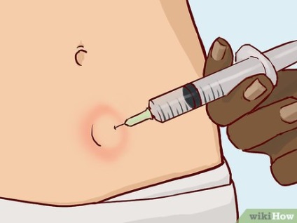 Cum se vindecă metodele populare lipomice