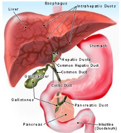 Cafea - curățarea de toxine - oncologie alternativă