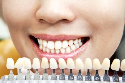 Caracteristicile de albire a dinților cosmetice ale procedurii