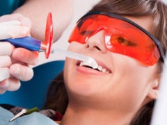A kozmetikai fogfehérítő jellemzői az eljárásnak