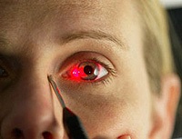 Tratamentul cu cataractă, boli oculare (oftalmologie), cataractă