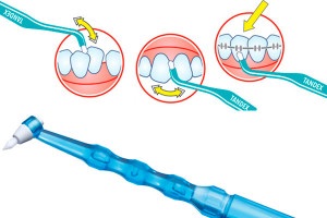 Periuța de dinți monobulară (mono-perie) ce este și cum să o utilizați