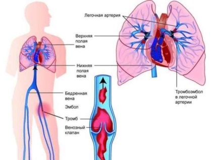 Tinctura de albine pe vodca, ce boli de băut