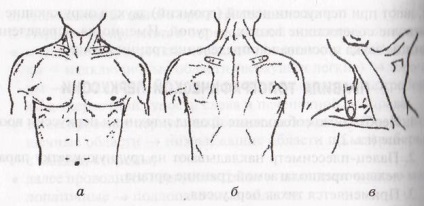 Determinarea lățimii marginilor kreniga (vârfurile plămânilor)