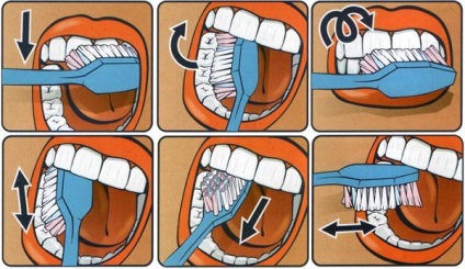 Reguli de bază pentru curățarea dinților - sfaturi pentru îngrijirea orală