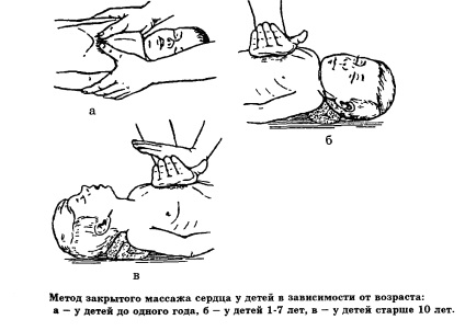 Resuscitarea cardiopulmonară primară la copii