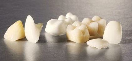 Coroane de plastic pe dinți (coroane de plastic) etapele de fabricație, prețuri, indicații pentru instalare