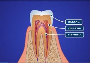 Dupa tratamentul dintelui doare sa apese cauzele