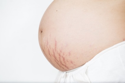 Măsurători în timpul sarcinii și modalități de prevenire