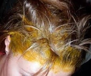 Maszkok receptek mustárral a haj növekedéséhez a hajhullás és erősítés érdekében