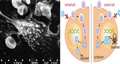 Cancer de zahăr, yul ivanchey, blog, nutriție adecvată