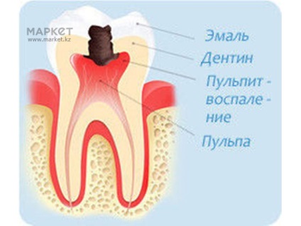 Петропавловск стоматология, зъбни импланти в Петропавловск, Петропавловск по стоматология - Център