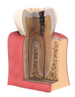 Петропавловск стоматология, зъбни импланти в Петропавловск, Петропавловск по стоматология - Център