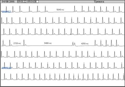 Tele-ecg monitorizare telemetrică eq în timp real, platformă de conținut