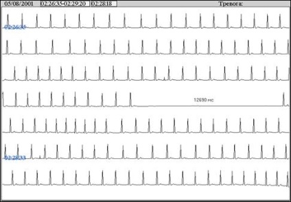 Tele-ecg monitorizare telemetrică eq în timp real, platformă de conținut