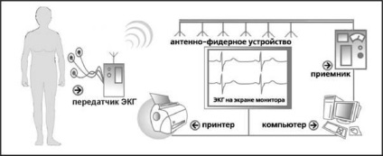 Tele-ecg monitorizare telemetrică eq în timp real, platformă de conținut