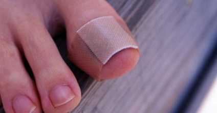 Leziuni ale unghiilor de la picior, tratarea daunelor