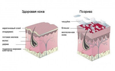 Oamenii de stiinta au sugerat utilizarea unui tomograf pentru tratamentul cancerului