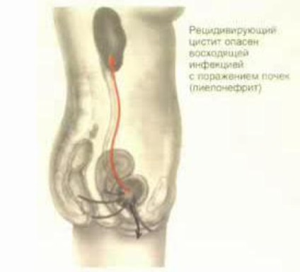 Întunecarea în rinichi pe radiografia pe care se poate afla