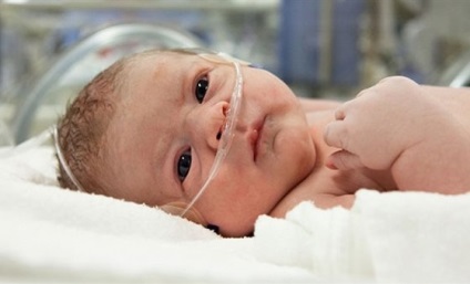 Inversiunea intestinelor la nou-născuți și copii de la ceea ce se întâmplă, cauze, simptome, tratament