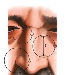 Anatomia pliurilor nazolabiale - blogul proiectului omorfia