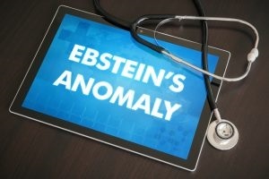 Ebstein simptomele anomaliului și principiile de tratament
