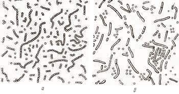 Bacteriile din must și vin (partea 2)