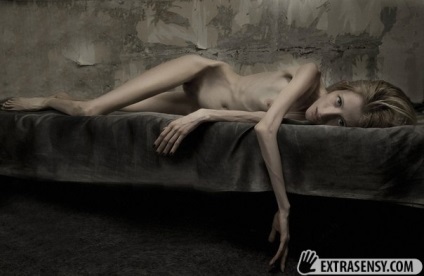 A pszichikai csata az anorexia miatt