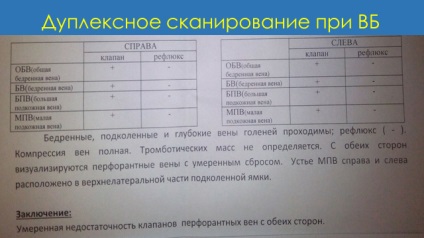 Eugene Ilyukhin - ultrasunete este standardul pentru diagnosticarea bolilor venoase, dar este întotdeauna