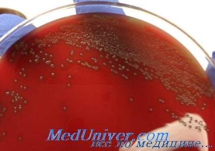 Pneumococcus (streptococcus pneumoniae) okozta fertőzés diagnosztizálása, kezelése, megelőzése