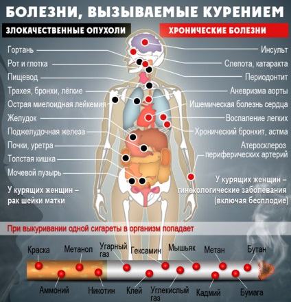 Cum să renunți la fumat în vârstă - întrebări populare